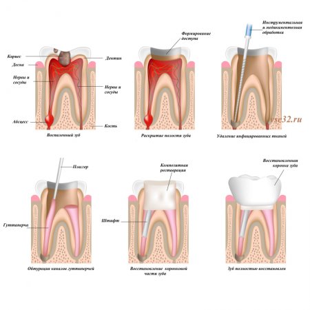 О лечении зубов в деталях